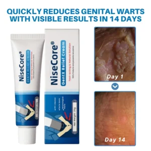 NiseCore® HPV Genital Warts Relief Cream