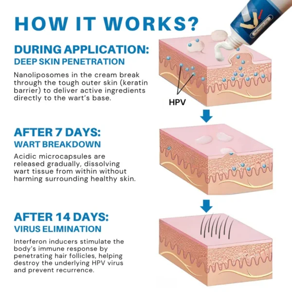 NiseCore® HPV Genital Warts Relief Cream
